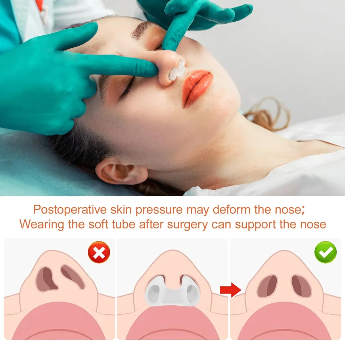 Baluue 2 supporti per narici per rinoplastica, supporto interno per naso, in silicone, per recupero post-intervento chirurgico e prevenzione della deformazione