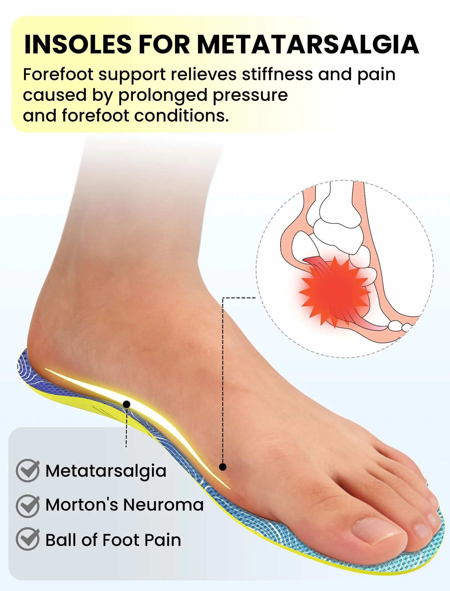 Plantari metatarsali per il sollievo dal neuroma di Morton – Sollievo dalla metatarsalgia per sport e corsa, supporto dell'avampiede per la fascite plantare, XL: 46-47