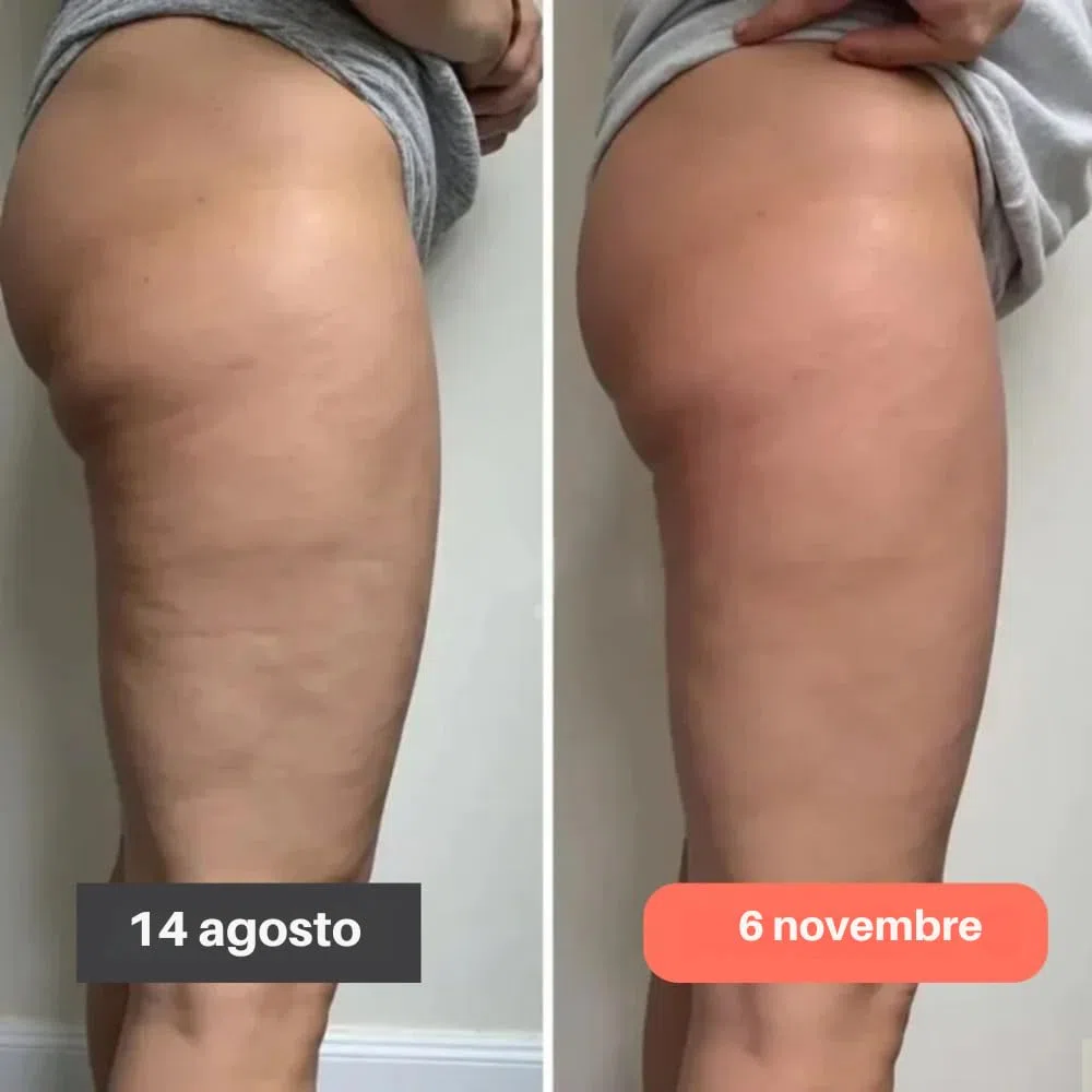 Fittabella Leggins 3D Anticellulite Donna, Fitta Bella Sculpture Leggings, Leggings Compressone Graduata Pantaloni Sportivi a Vita Alta per Fitness e Yoga